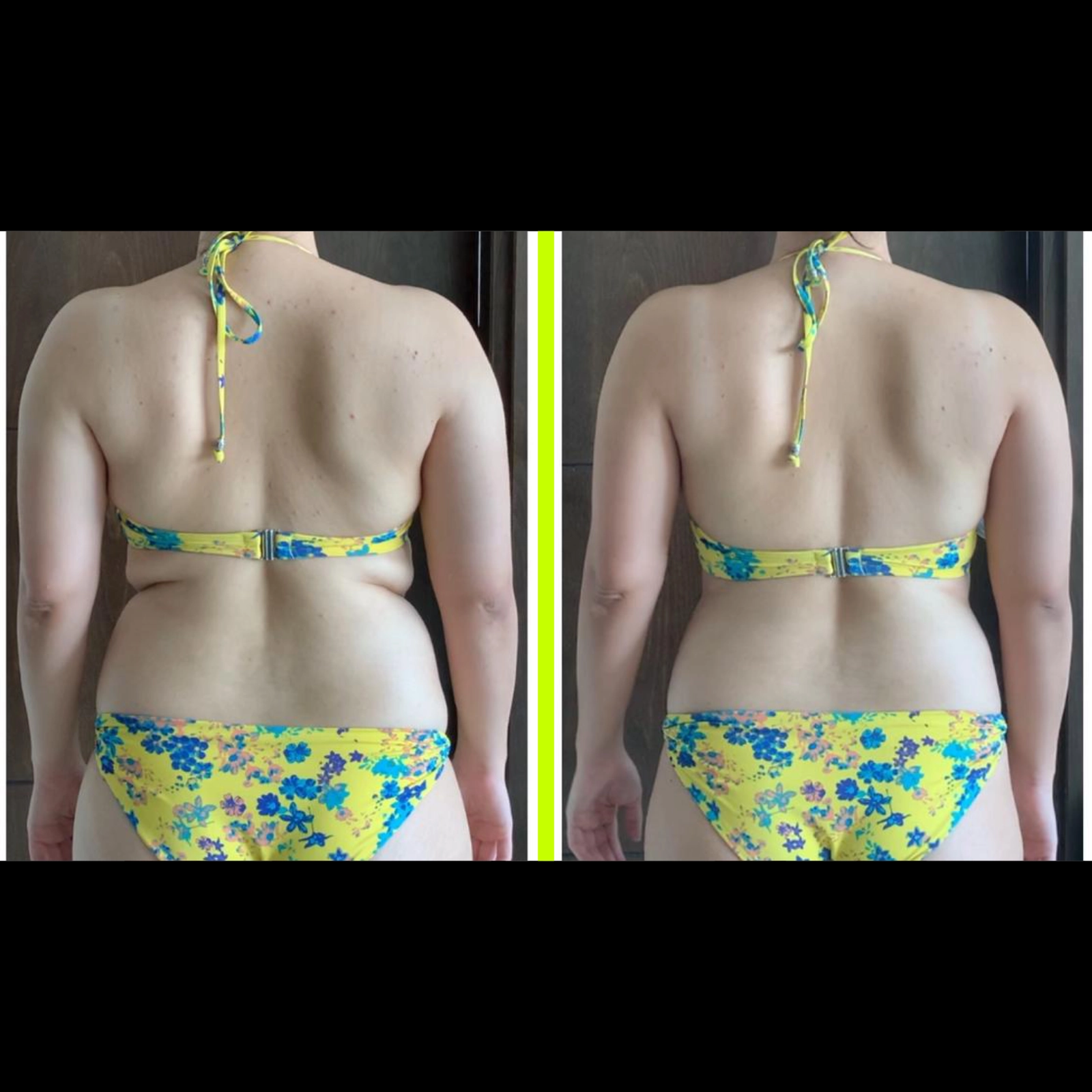 Before and After